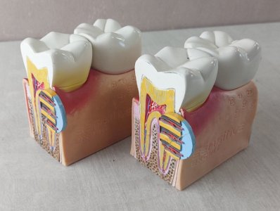 Vintage promotional items / curiosity / educational, teeth, Signal Sensitive