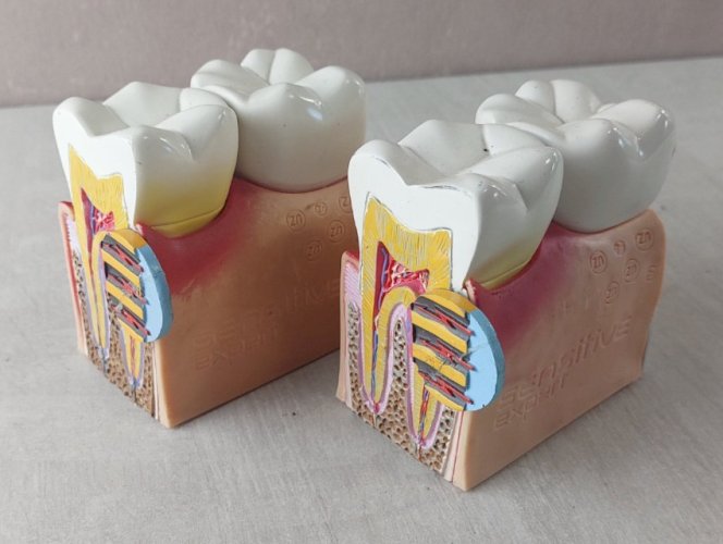 Anciens objets publicitaires / curiosité / éducatif, dents, Signal Sensitive