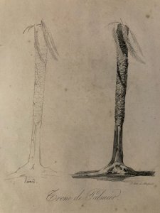 Gravure Arbre Art Tronc Delpech Remond 1829 Lithographie Palmier XIXe